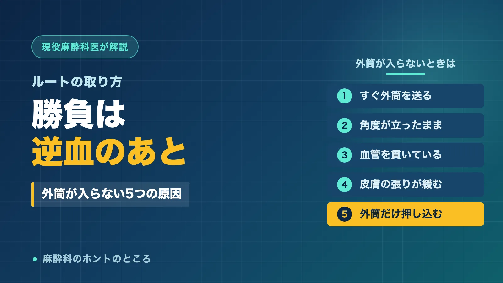 ルートの取り方で外筒が入らない5つの原因を示したアイキャッチ画像