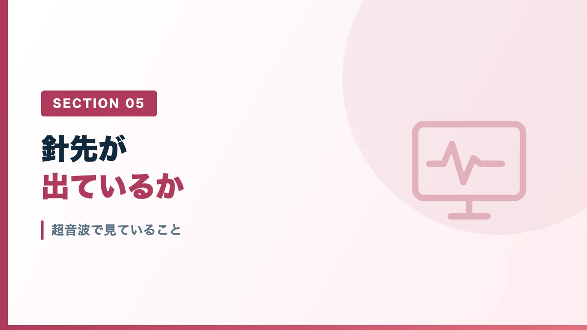 超音波ガイド下の神経ブロックで見ていることを表すバナー画像